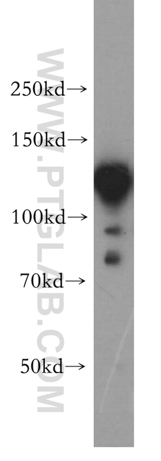 HNRNPU Antibody in Western Blot (WB)