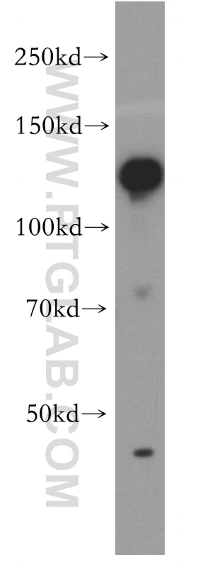 HNRNPU Antibody in Western Blot (WB)