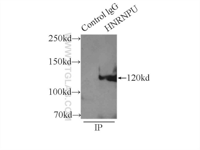 HNRNPU Antibody in Immunoprecipitation (IP)