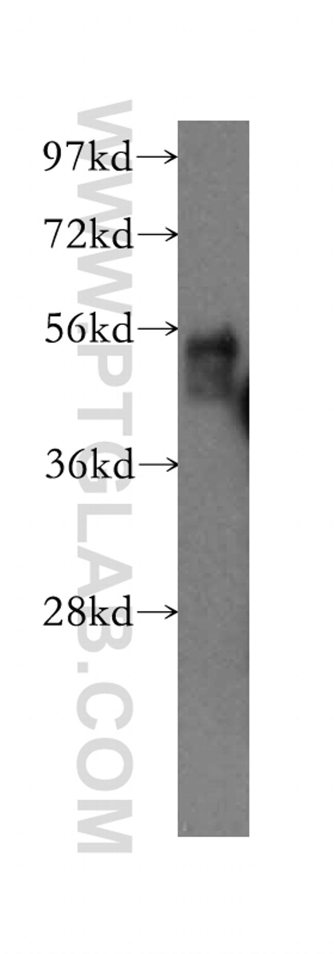 FZR1 Antibody in Western Blot (WB)