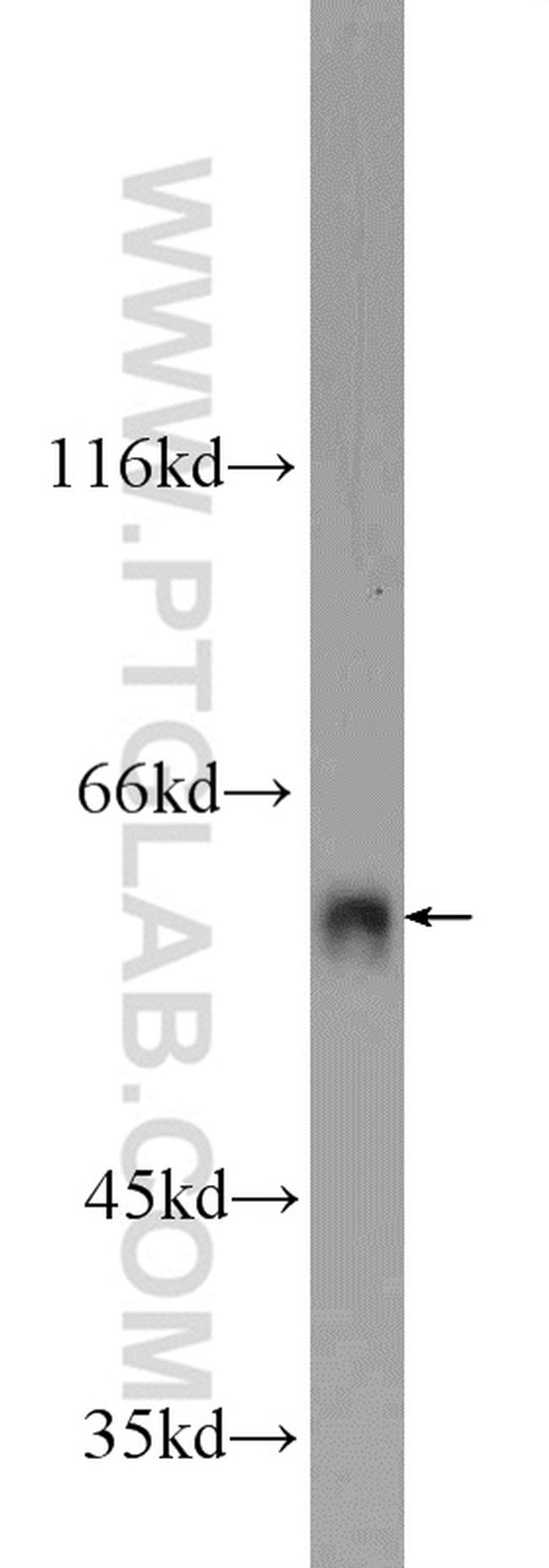 FZR1 Antibody in Western Blot (WB)