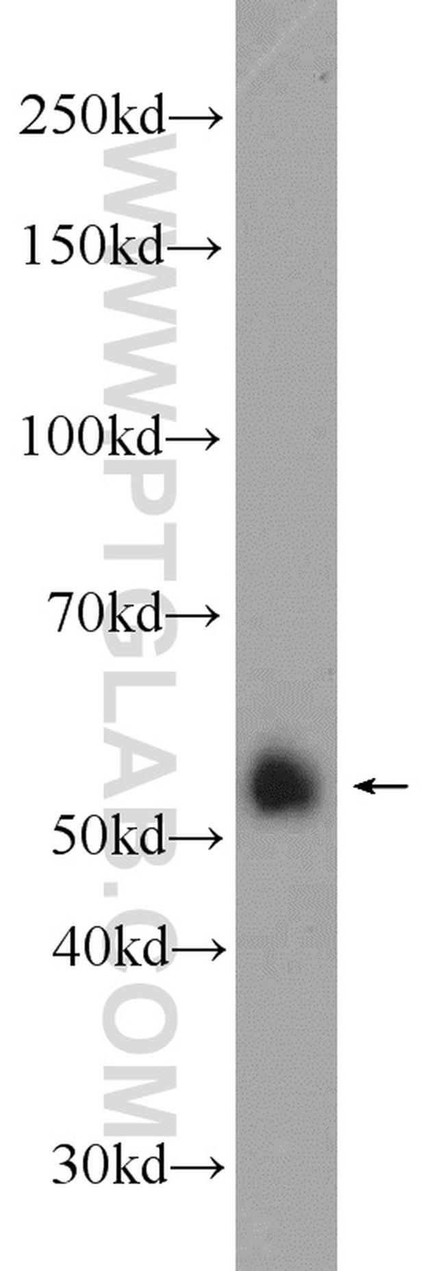 FZR1 Antibody in Western Blot (WB)