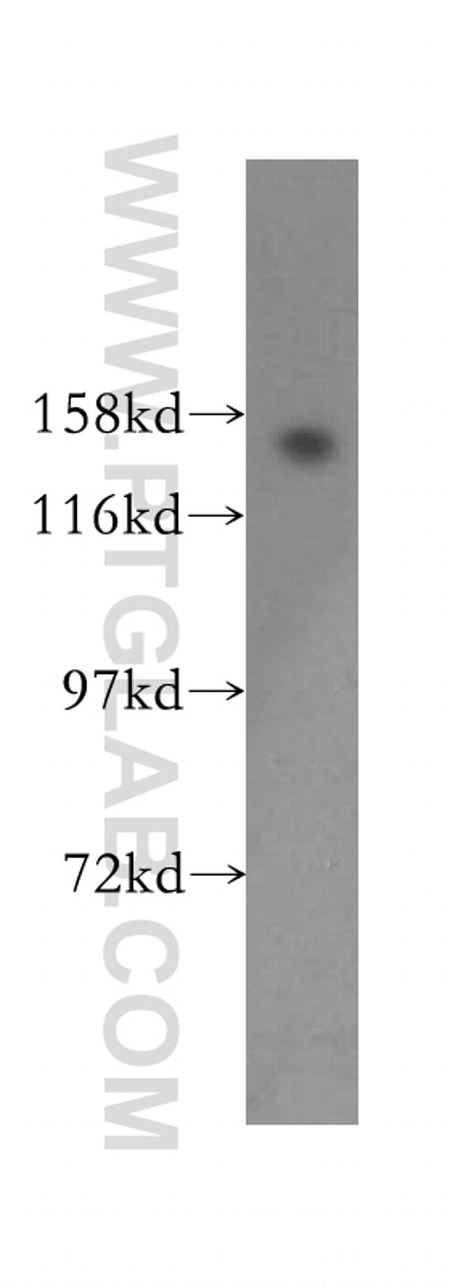 WAPL/WAPAL Antibody in Western Blot (WB)