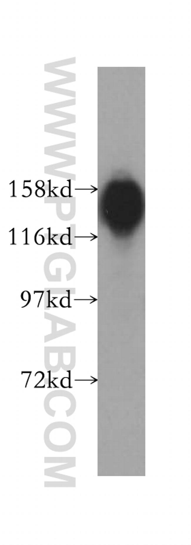 WAPL/WAPAL Antibody in Western Blot (WB)