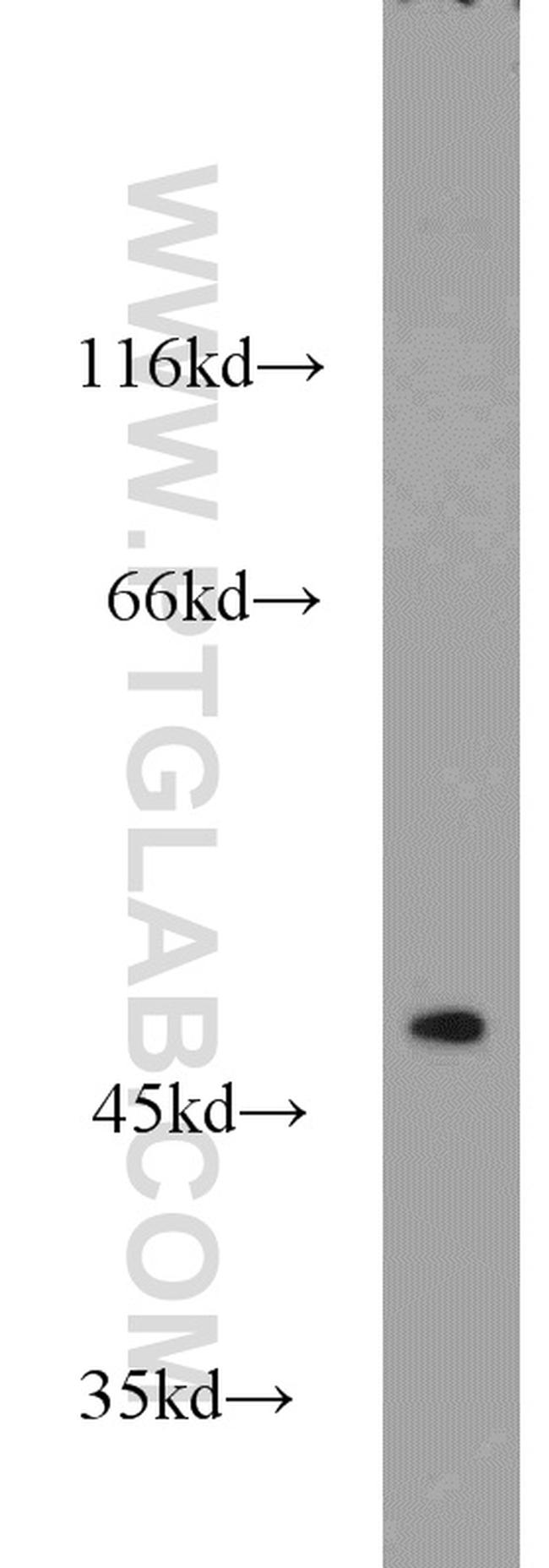 ADSS Antibody in Western Blot (WB)