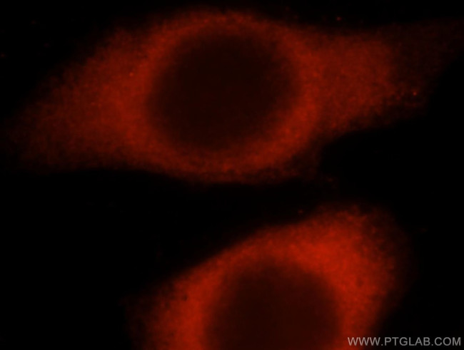 HARS Antibody in Immunocytochemistry (ICC/IF)