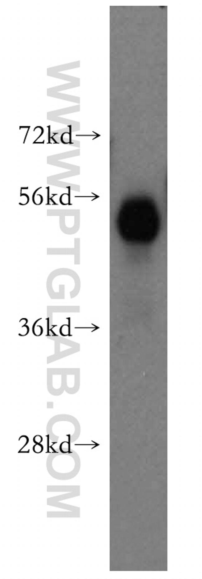 HARS Antibody in Western Blot (WB)