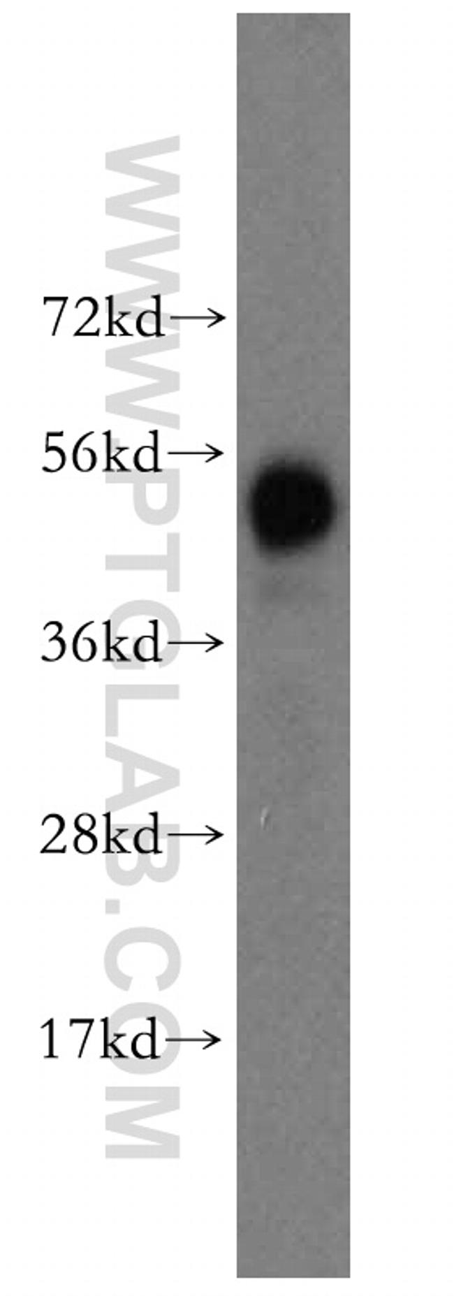 HARS Antibody in Western Blot (WB)