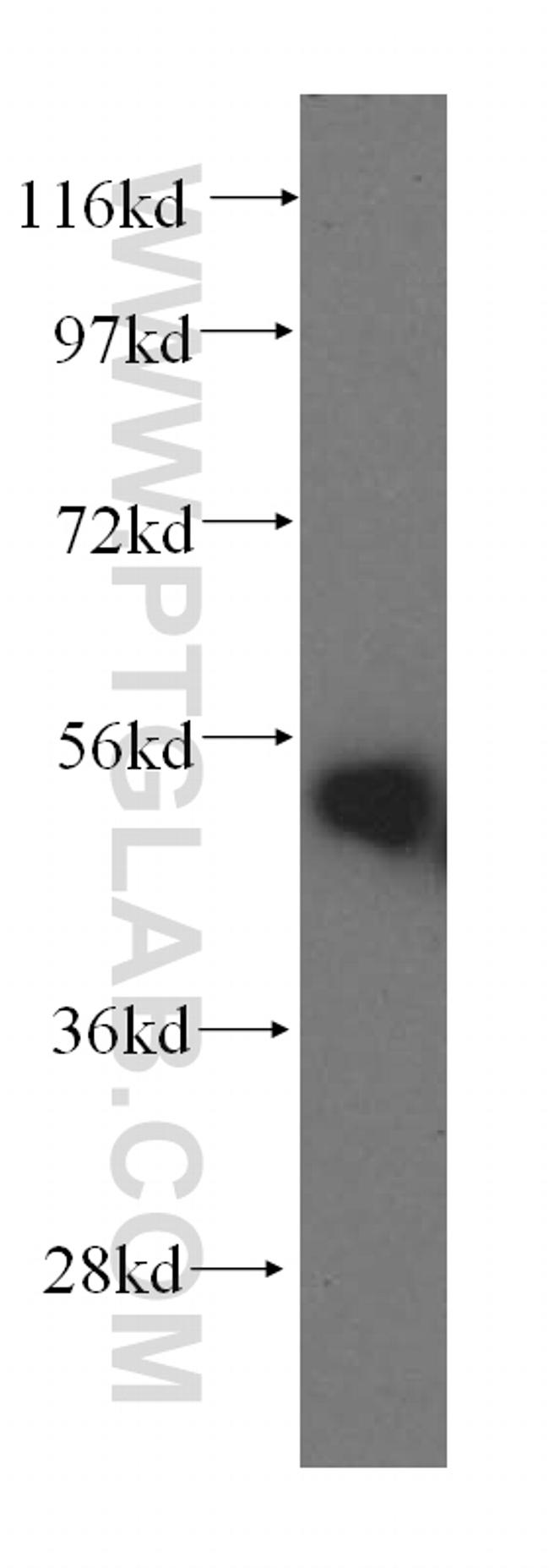 HARS Antibody in Western Blot (WB)