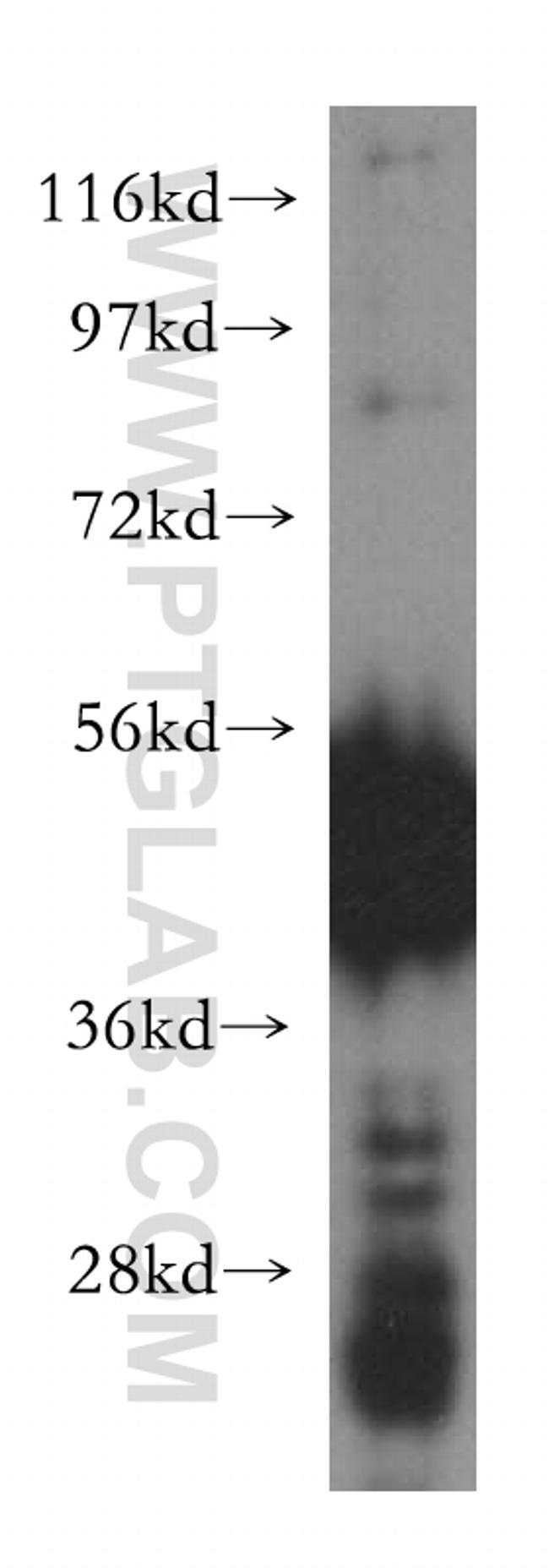 HARS Antibody in Western Blot (WB)