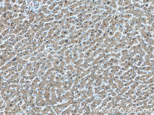 GMPS Antibody in Immunohistochemistry (Paraffin) (IHC (P))