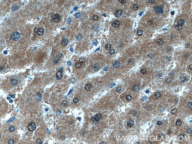 GMPS Antibody in Immunohistochemistry (Paraffin) (IHC (P))