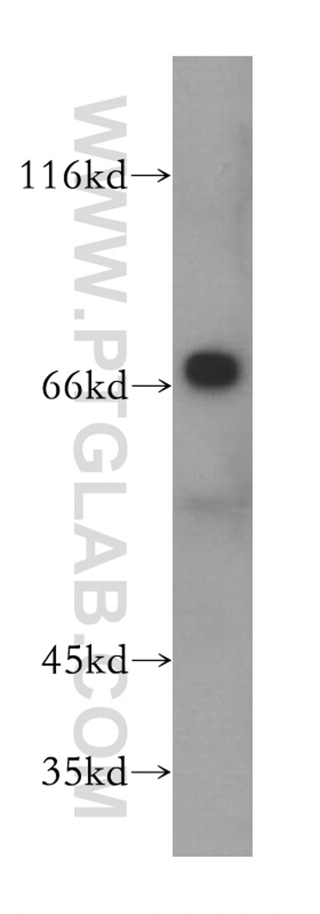 GMPS Antibody in Western Blot (WB)