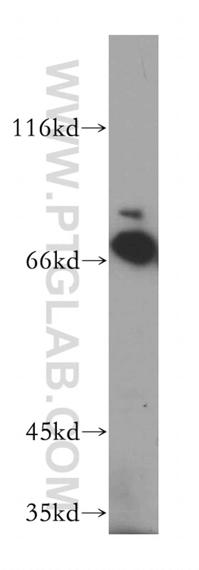 GMPS Antibody in Western Blot (WB)