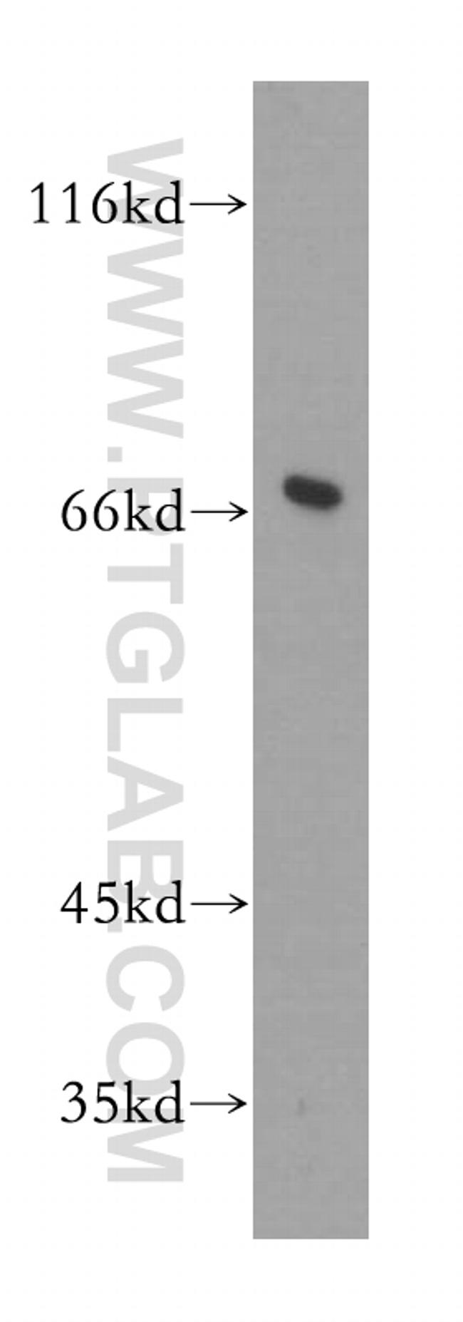 GMPS Antibody in Western Blot (WB)