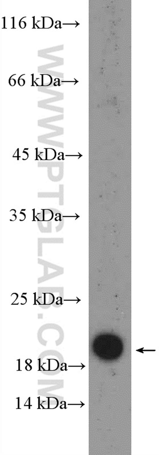 RPP21 Antibody in Western Blot (WB)