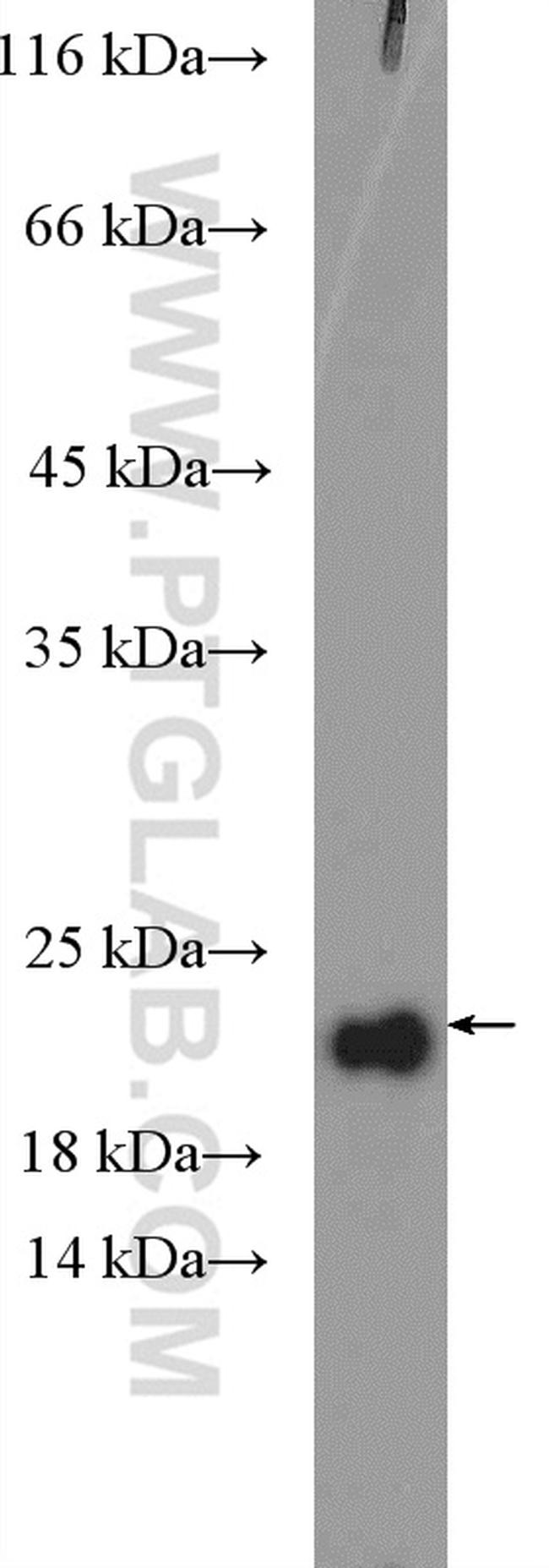 RPP21 Antibody in Western Blot (WB)