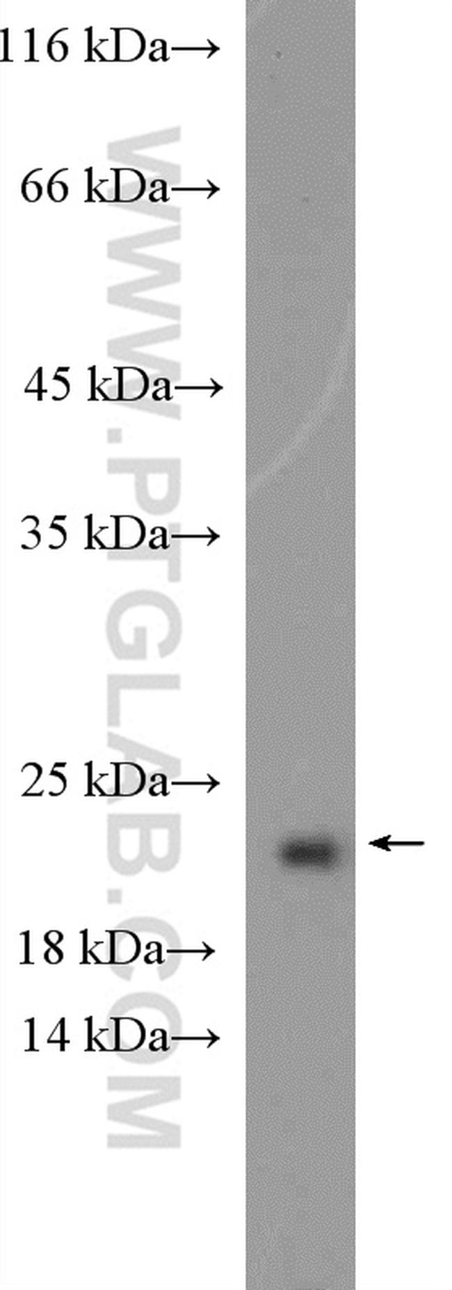 RPP21 Antibody in Western Blot (WB)