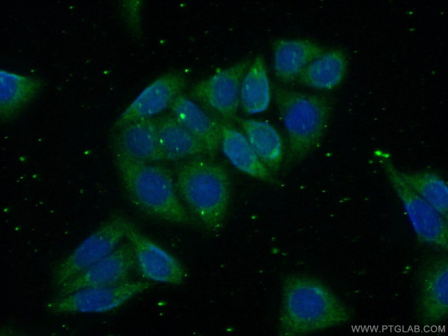 GSNOR/ADH5 Antibody in Immunocytochemistry (ICC/IF)