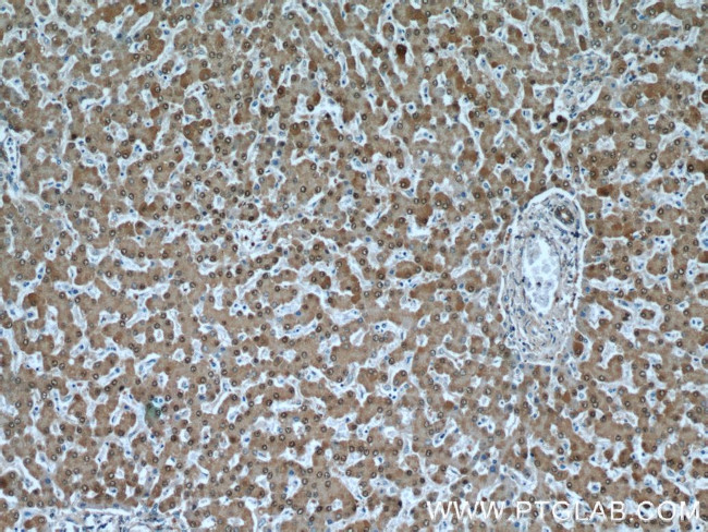 GSNOR/ADH5 Antibody in Immunohistochemistry (Paraffin) (IHC (P))