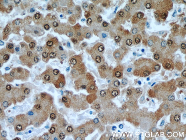 GSNOR/ADH5 Antibody in Immunohistochemistry (Paraffin) (IHC (P))