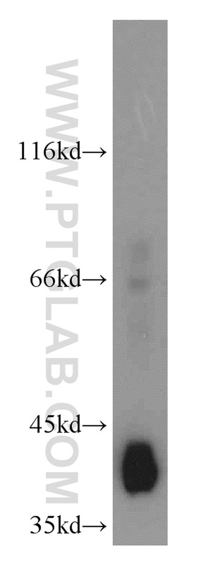 GSNOR/ADH5 Antibody in Western Blot (WB)