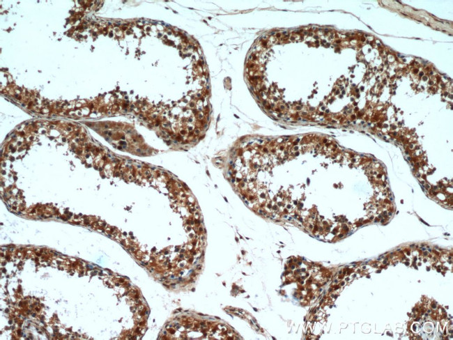 GSNOR/ADH5 Antibody in Immunohistochemistry (Paraffin) (IHC (P))