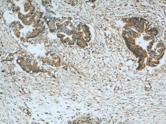 GSNOR/ADH5 Antibody in Immunohistochemistry (Paraffin) (IHC (P))