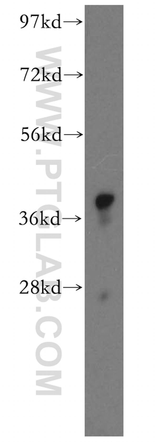 GSNOR/ADH5 Antibody in Western Blot (WB)