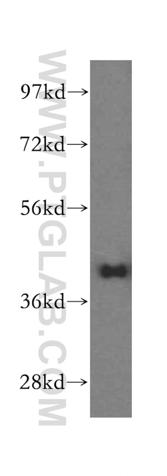 GSNOR/ADH5 Antibody in Western Blot (WB)