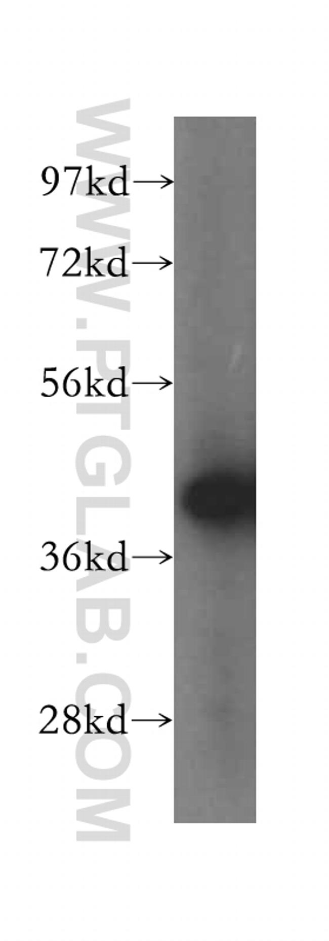 GSNOR/ADH5 Antibody in Western Blot (WB)