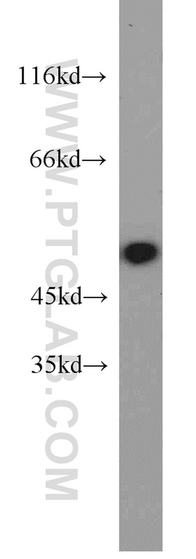 Alpha-1-Antitrypsin Antibody in Western Blot (WB)