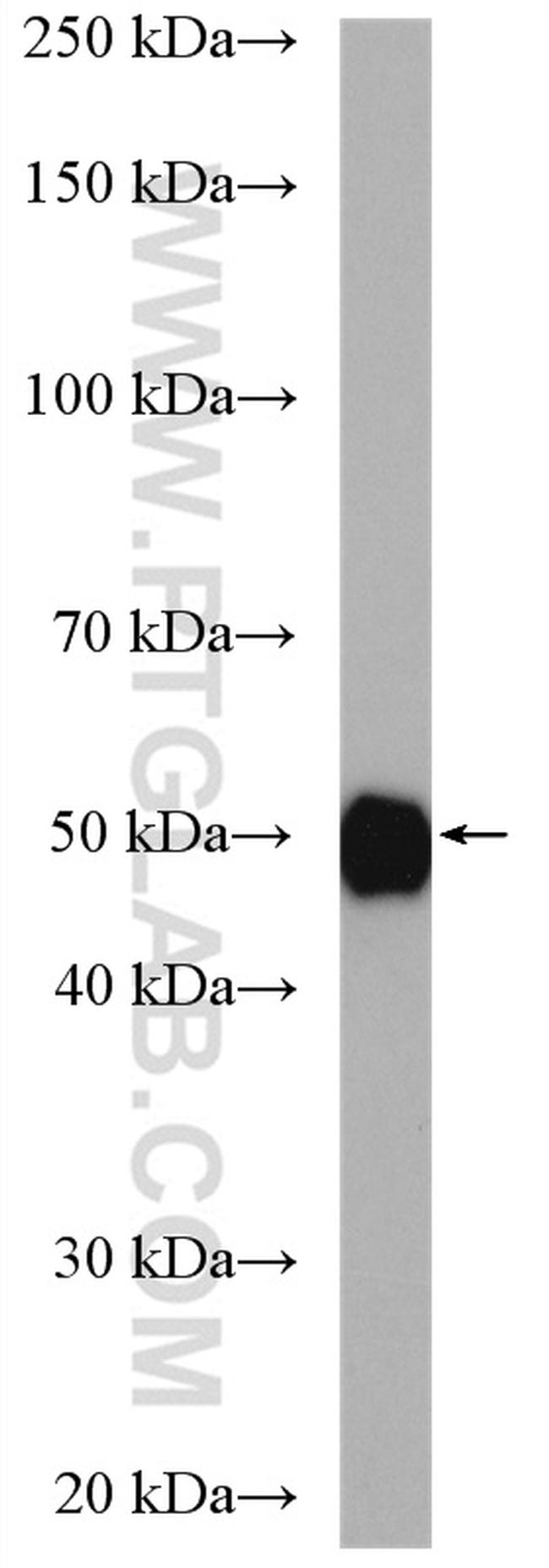 Alpha-1-Antitrypsin Antibody in Western Blot (WB)