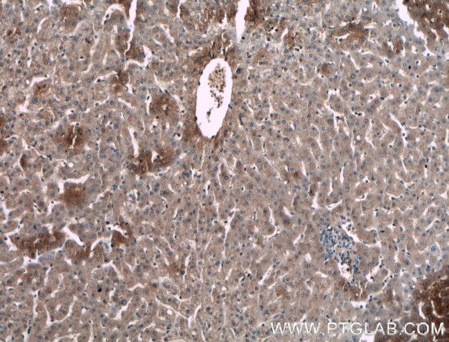 Alpha-1-Antitrypsin Antibody in Immunohistochemistry (Paraffin) (IHC (P))