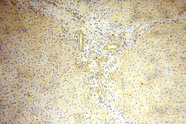 RPL23A Antibody in Immunohistochemistry (Paraffin) (IHC (P))