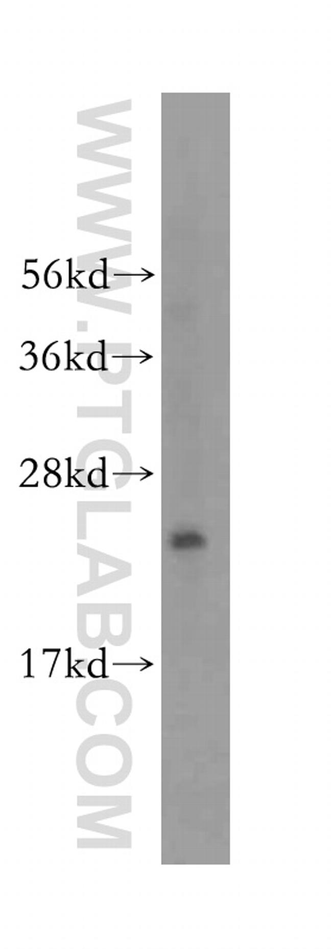 RPL23A Antibody in Western Blot (WB)