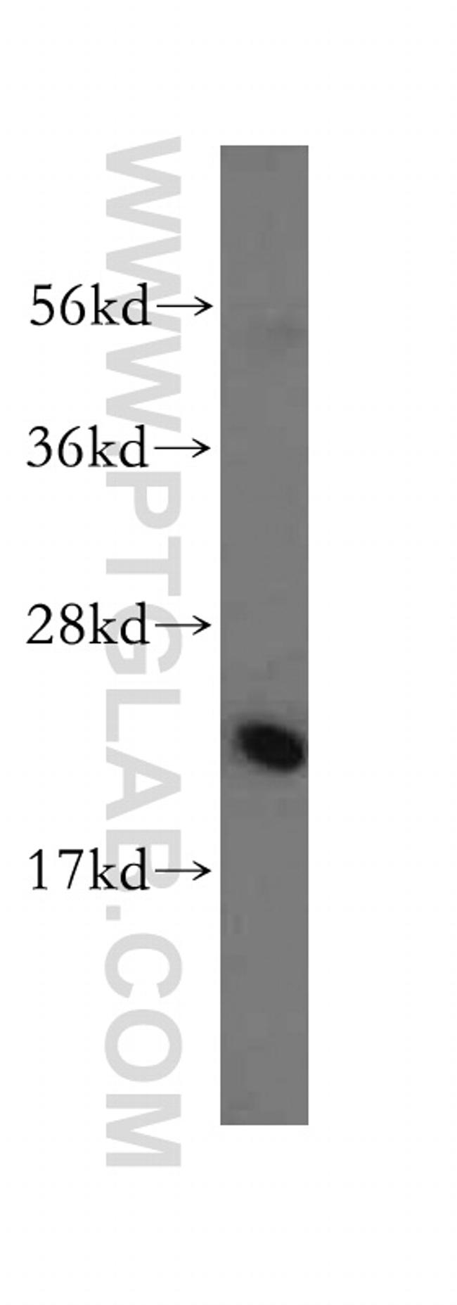 RPL23A Antibody in Western Blot (WB)