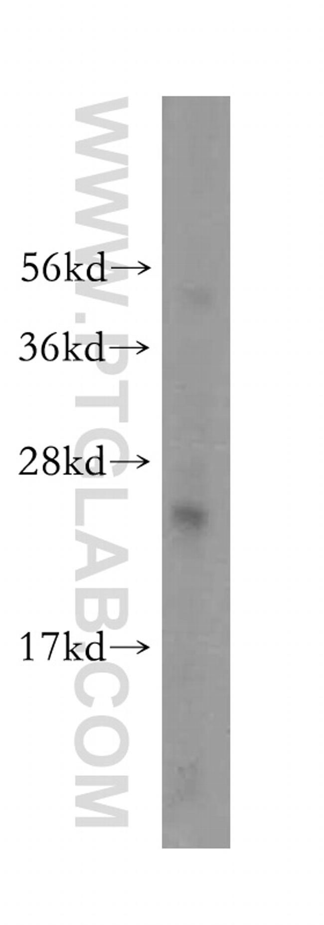 RPL23A Antibody in Western Blot (WB)