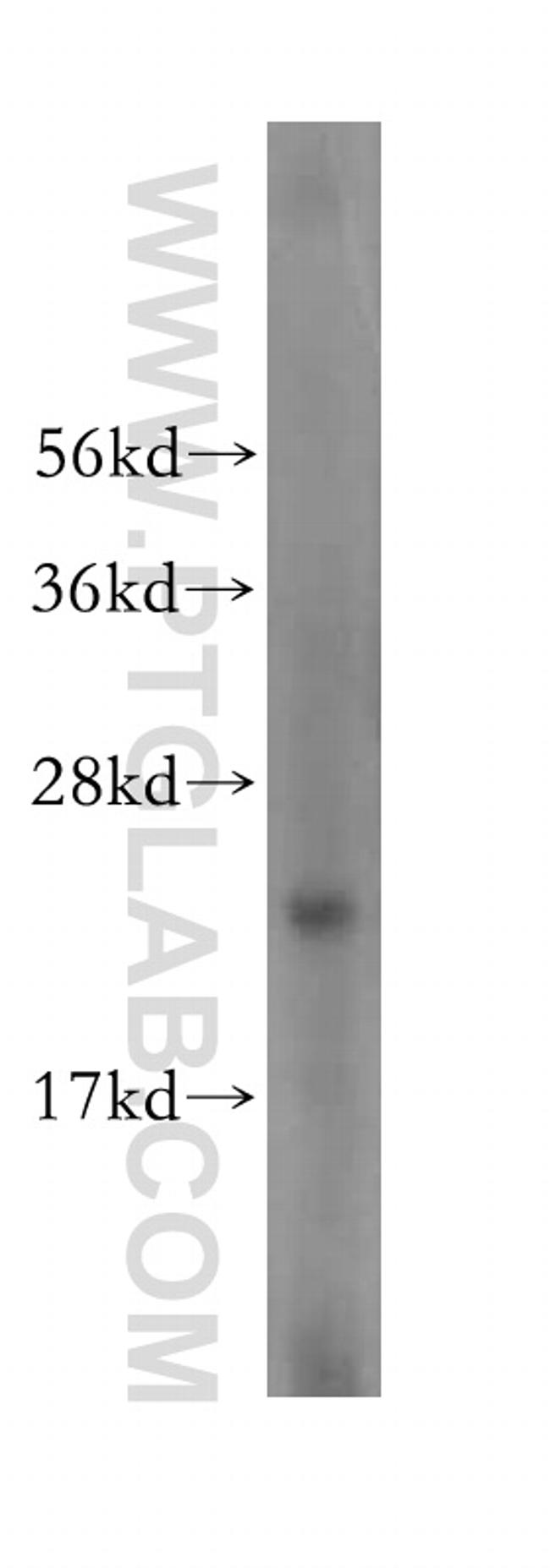 RPL23A Antibody in Western Blot (WB)