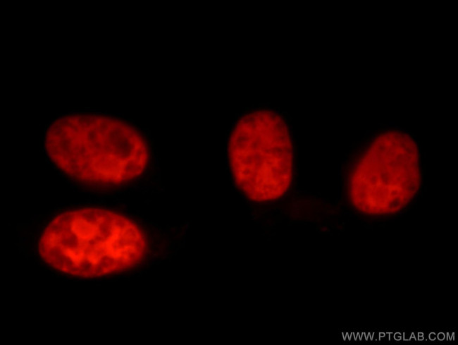 XRCC5/Ku80 Antibody in Immunocytochemistry (ICC/IF)