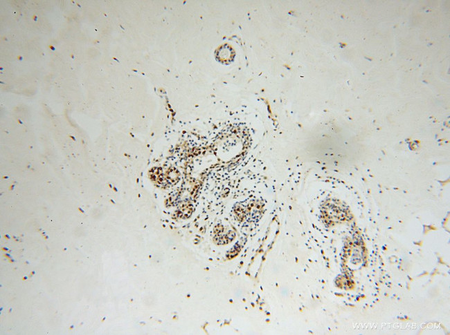 XRCC5/Ku80 Antibody in Immunohistochemistry (Paraffin) (IHC (P))