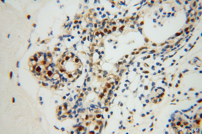 XRCC5/Ku80 Antibody in Immunohistochemistry (Paraffin) (IHC (P))