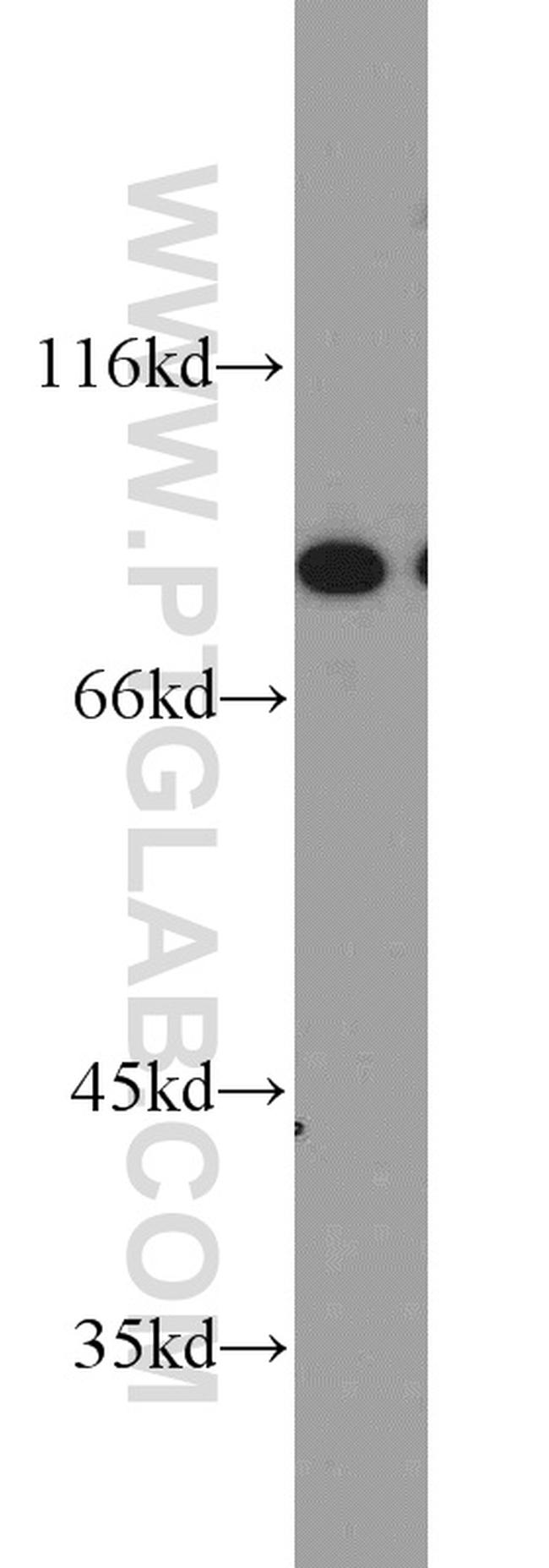 XRCC5/Ku80 Antibody in Western Blot (WB)