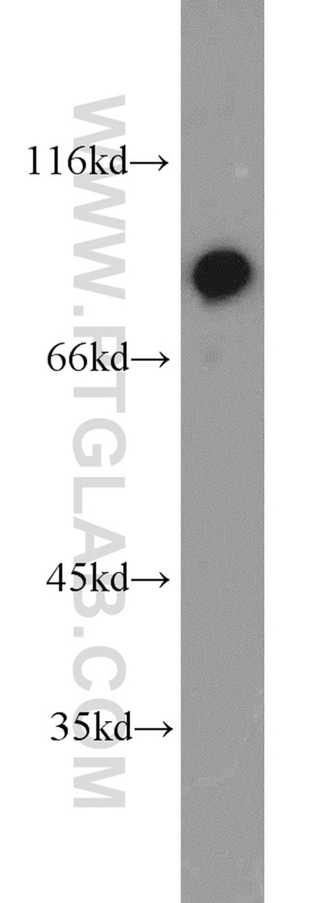 XRCC5/Ku80 Antibody in Western Blot (WB)