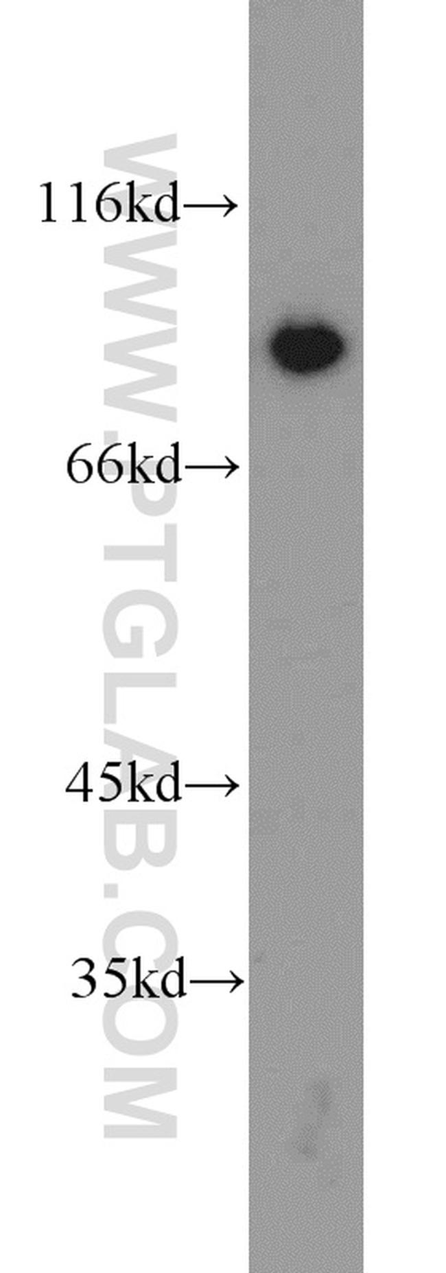 XRCC5/Ku80 Antibody in Western Blot (WB)