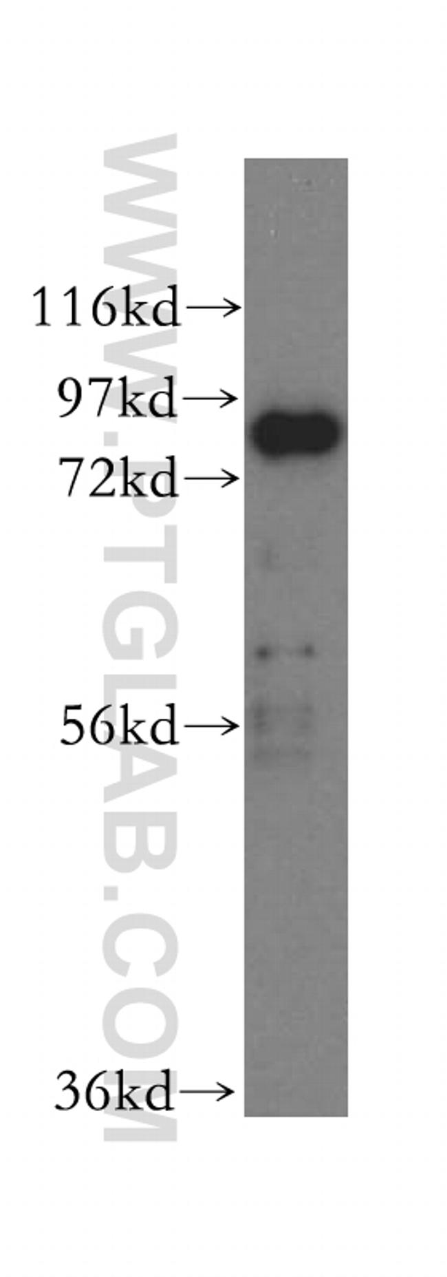 XRCC5/Ku80 Antibody in Western Blot (WB)