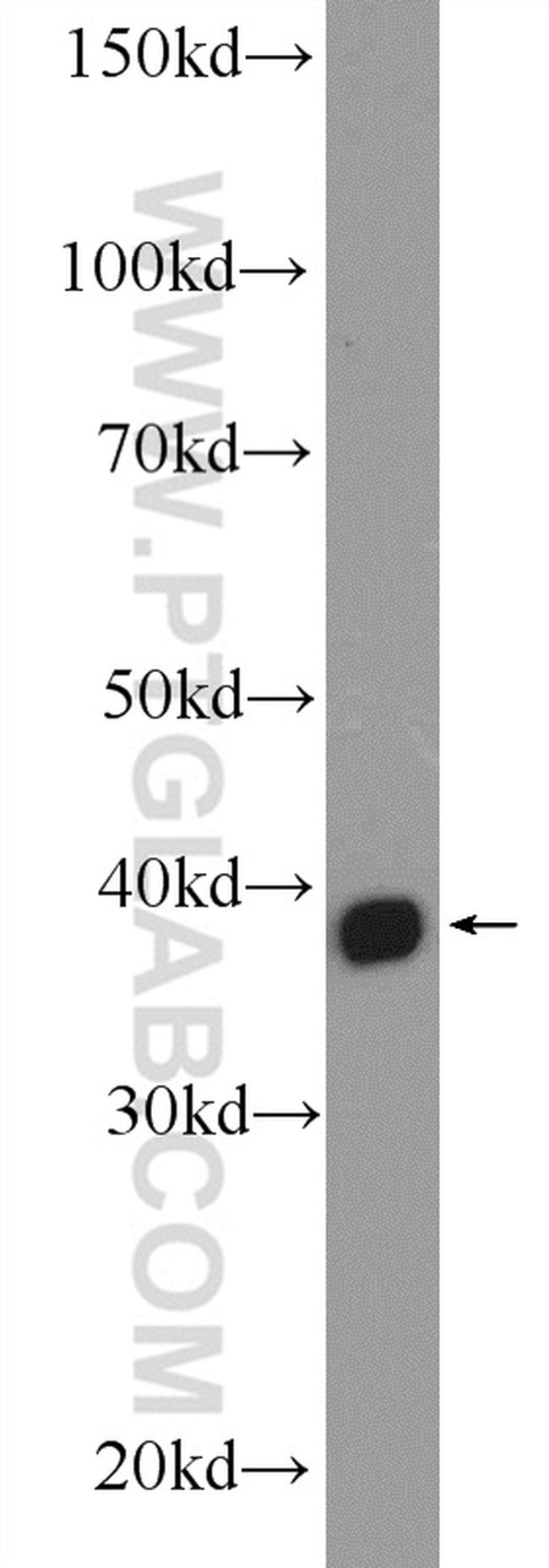 MRM1 Antibody in Western Blot (WB)