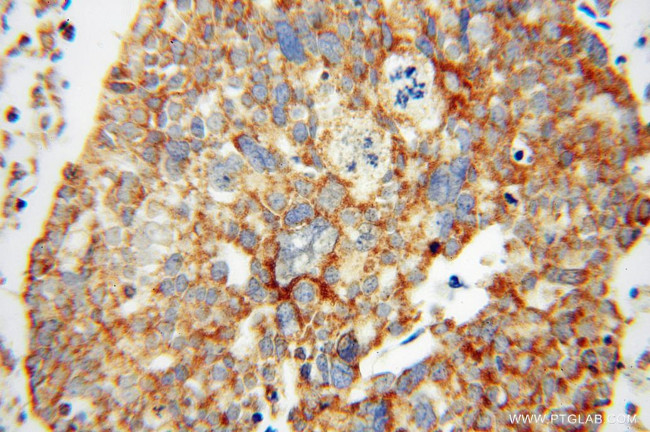 MRPL44 Antibody in Immunohistochemistry (Paraffin) (IHC (P))