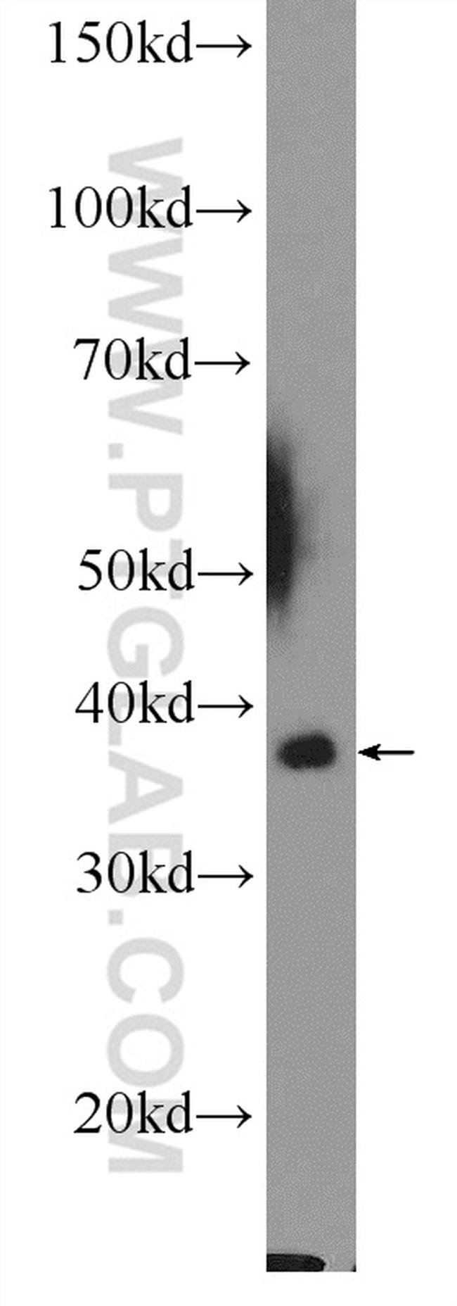 MRPL44 Antibody in Western Blot (WB)