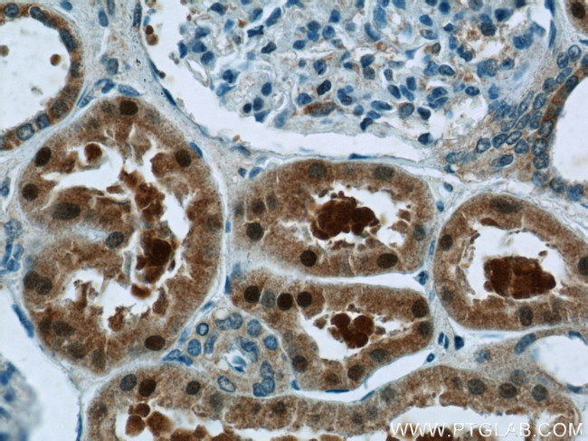 NRF2/NFE2L2 Antibody in Immunohistochemistry (Paraffin) (IHC (P))